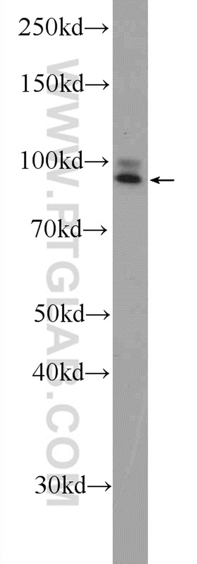 STRN3 Antibody in Western Blot (WB)