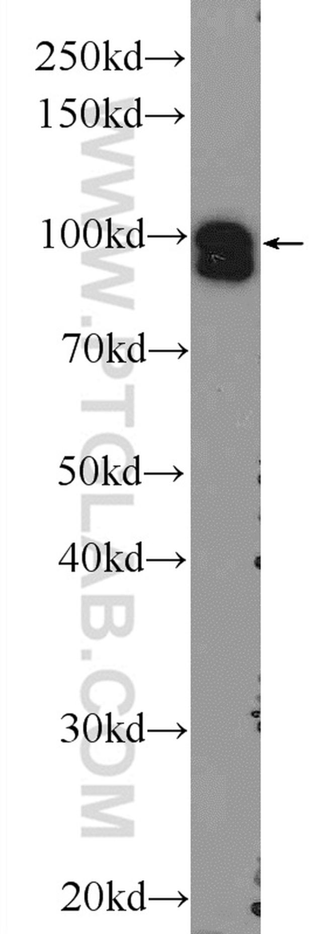 STRN3 Antibody in Western Blot (WB)