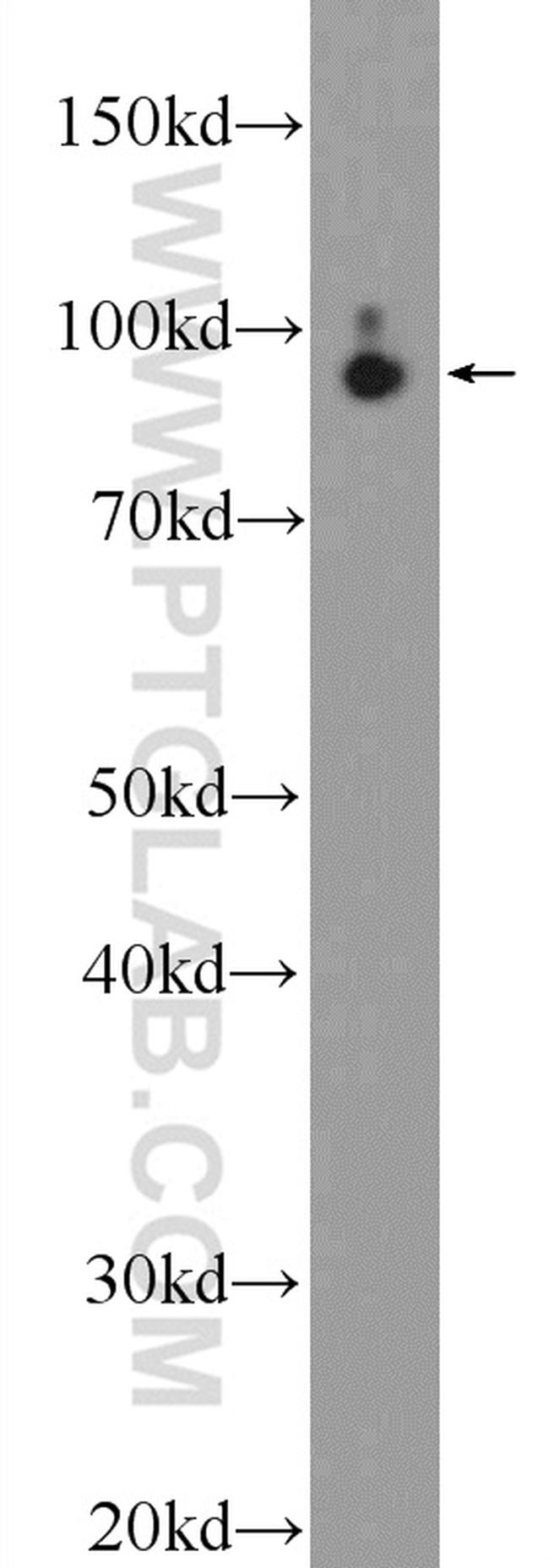 STRN3 Antibody in Western Blot (WB)