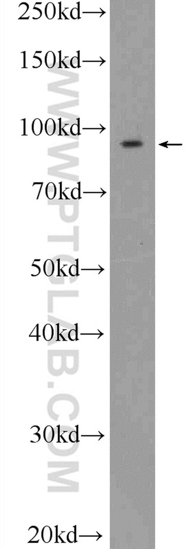 STRN3 Antibody in Western Blot (WB)