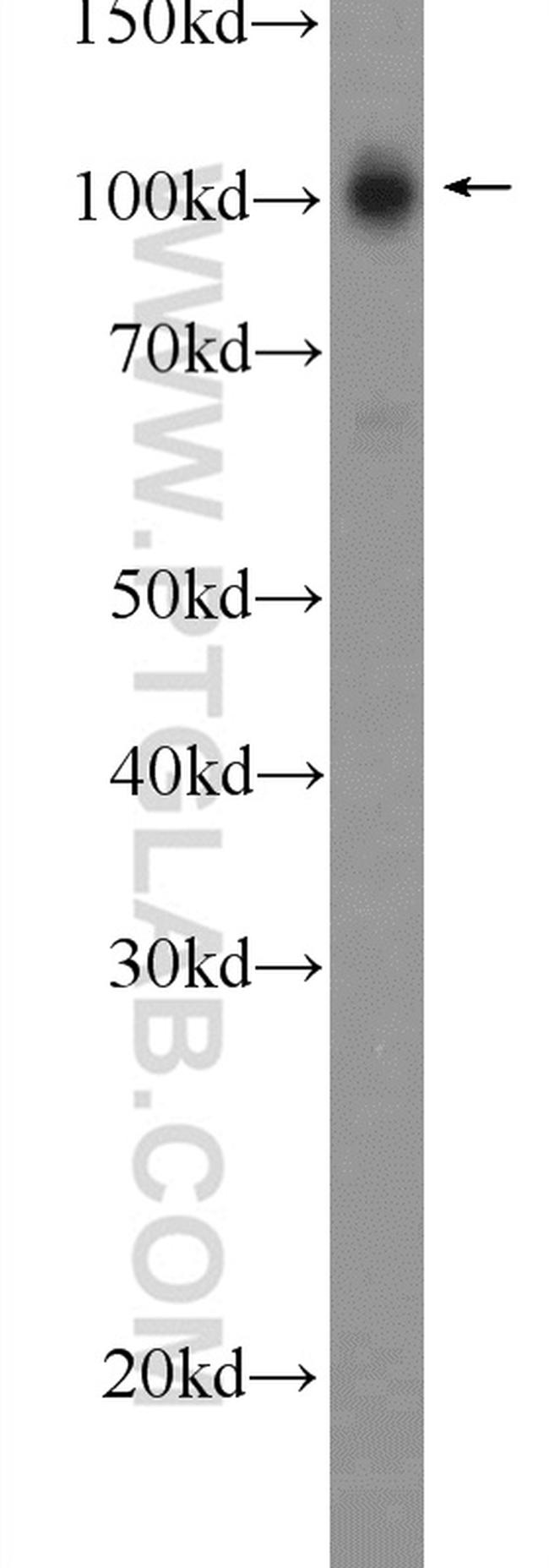 STRN3 Antibody in Western Blot (WB)