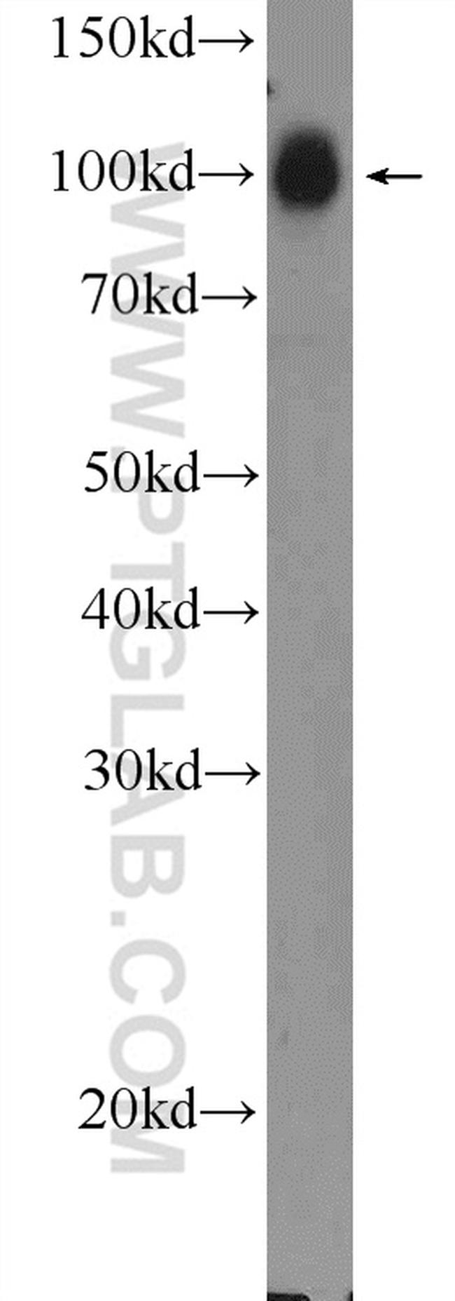 STRN3 Antibody in Western Blot (WB)