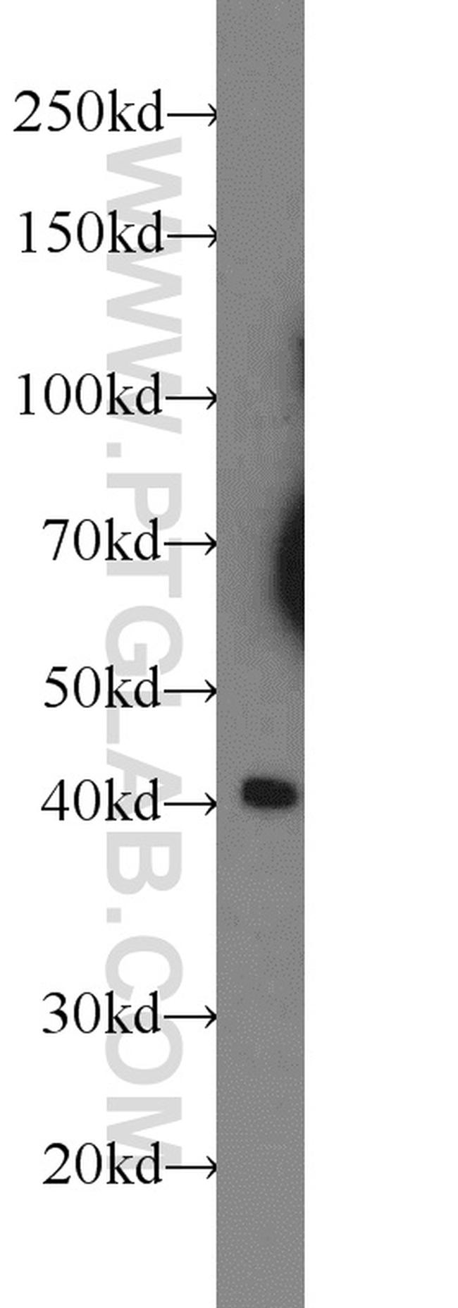 XKR6 Antibody in Western Blot (WB)