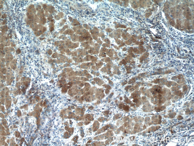 Angiotensinogen Antibody in Immunohistochemistry (Paraffin) (IHC (P))