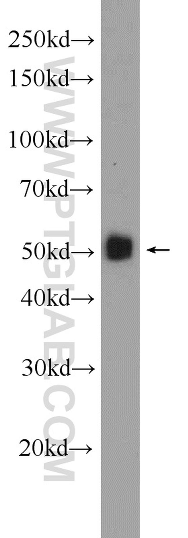 Angiotensinogen Antibody in Western Blot (WB)