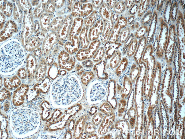 Angiotensinogen Antibody in Immunohistochemistry (Paraffin) (IHC (P))