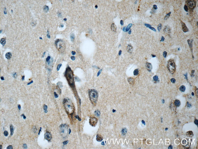 EB3 Antibody in Immunohistochemistry (Paraffin) (IHC (P))