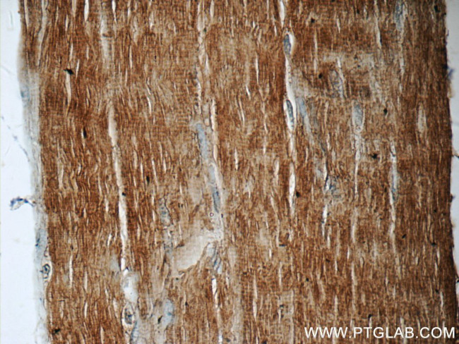 EB3 Antibody in Immunohistochemistry (Paraffin) (IHC (P))