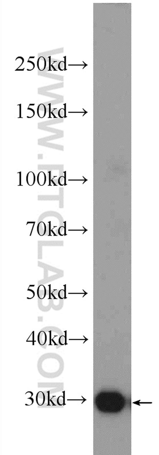 EB3 Antibody in Western Blot (WB)