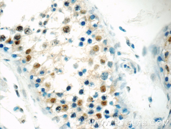 BARHL2 Antibody in Immunohistochemistry (Paraffin) (IHC (P))