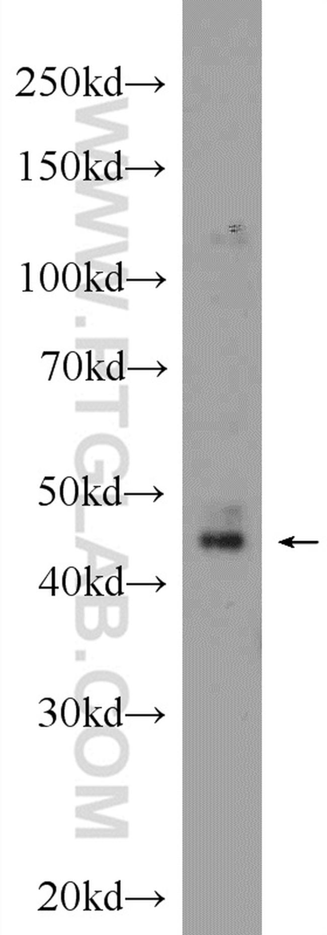 BARHL2 Antibody in Western Blot (WB)