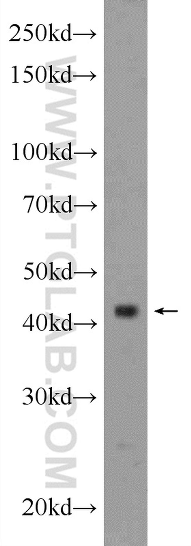 BARHL2 Antibody in Western Blot (WB)