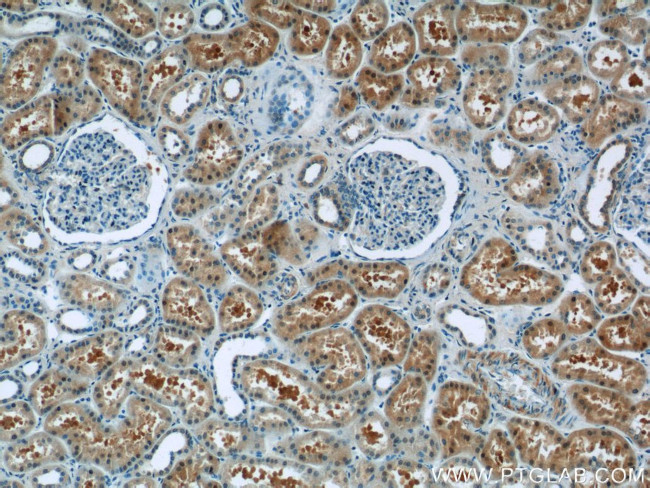 ZBTB20 Antibody in Immunohistochemistry (Paraffin) (IHC (P))