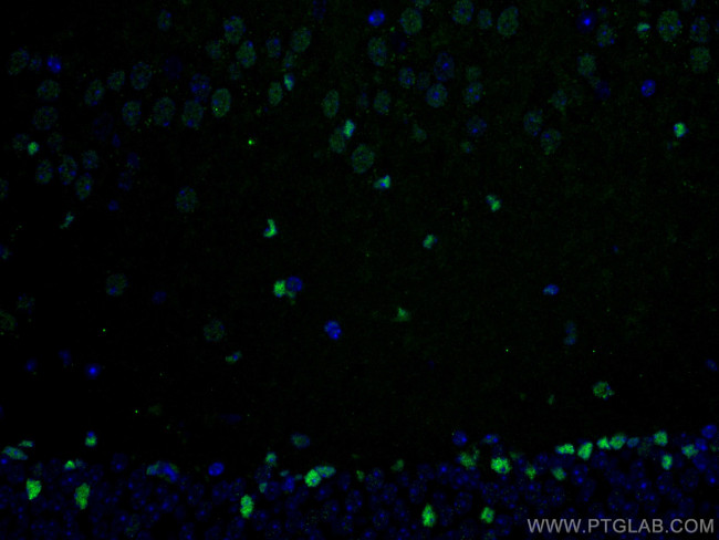 ZBTB20 Antibody in Immunohistochemistry (PFA fixed) (IHC (PFA))