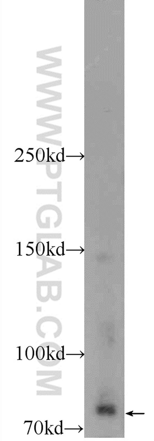 ZBTB20 Antibody in Western Blot (WB)