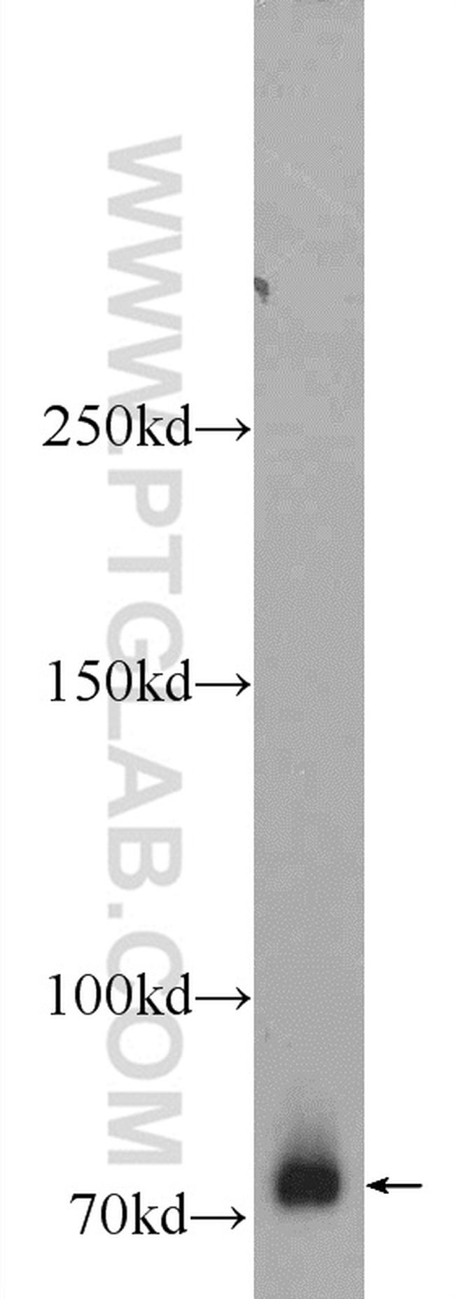 ZBTB20 Antibody in Western Blot (WB)