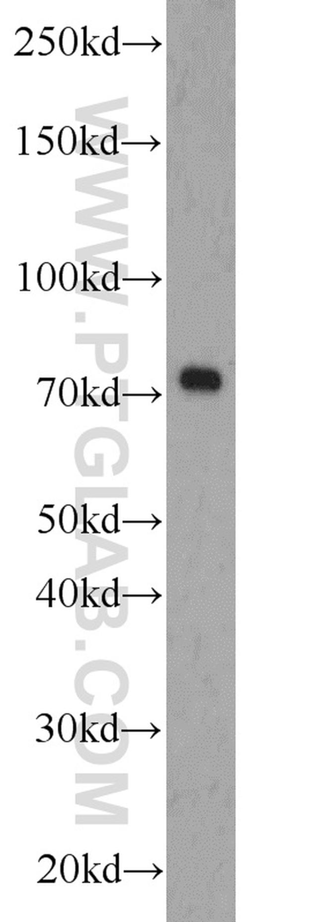 ZBTB20 Antibody in Western Blot (WB)