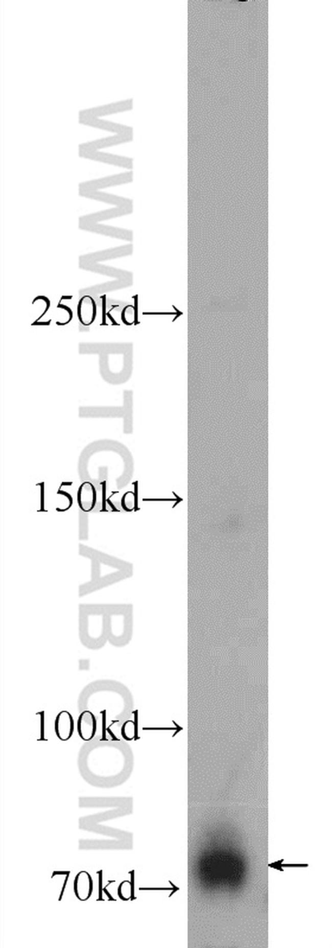 ZBTB20 Antibody in Western Blot (WB)