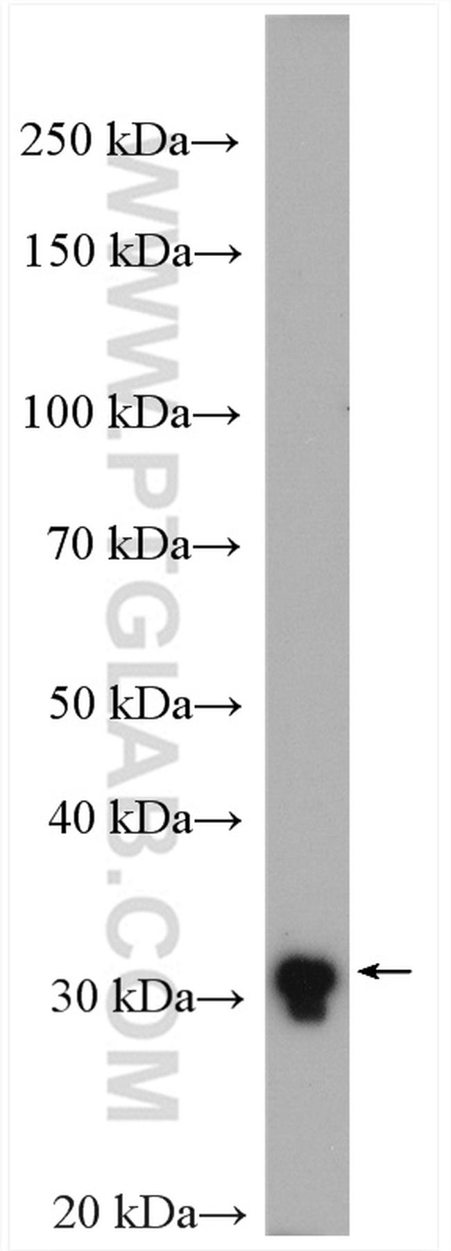 TMEM55B Antibody in Western Blot (WB)