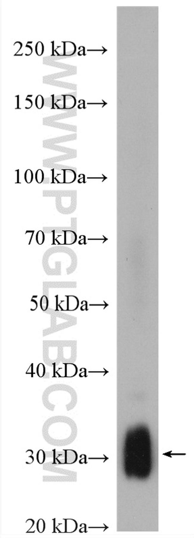 TMEM55B Antibody in Western Blot (WB)