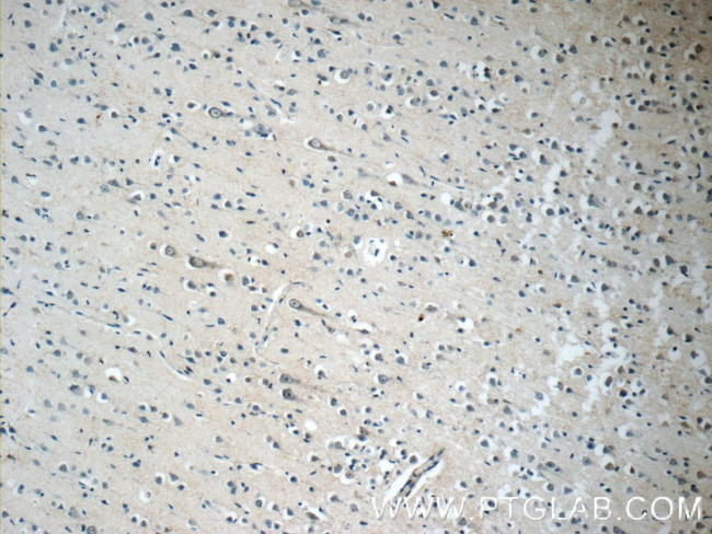 TFAM Antibody in Immunohistochemistry (Paraffin) (IHC (P))