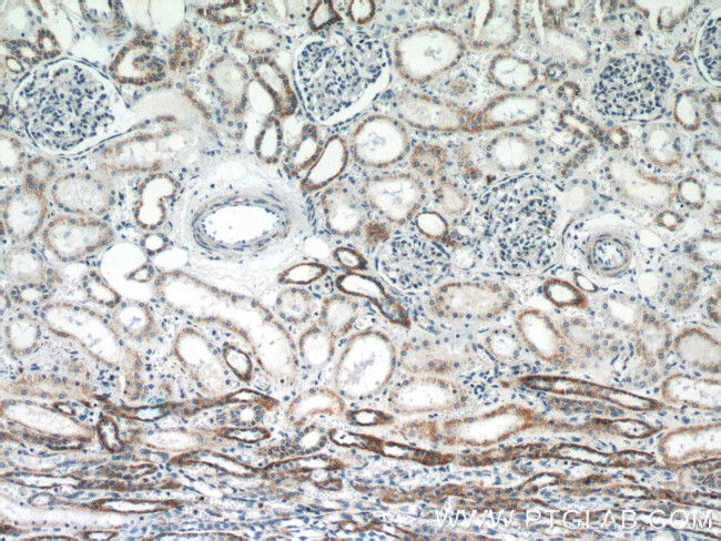 TFAM Antibody in Immunohistochemistry (Paraffin) (IHC (P))