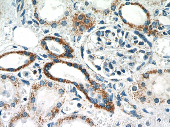 TFAM Antibody in Immunohistochemistry (Paraffin) (IHC (P))