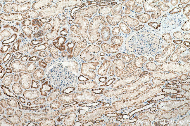 TFAM Antibody in Immunohistochemistry (Paraffin) (IHC (P))