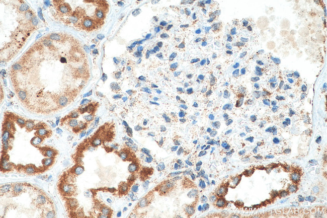 TFAM Antibody in Immunohistochemistry (Paraffin) (IHC (P))