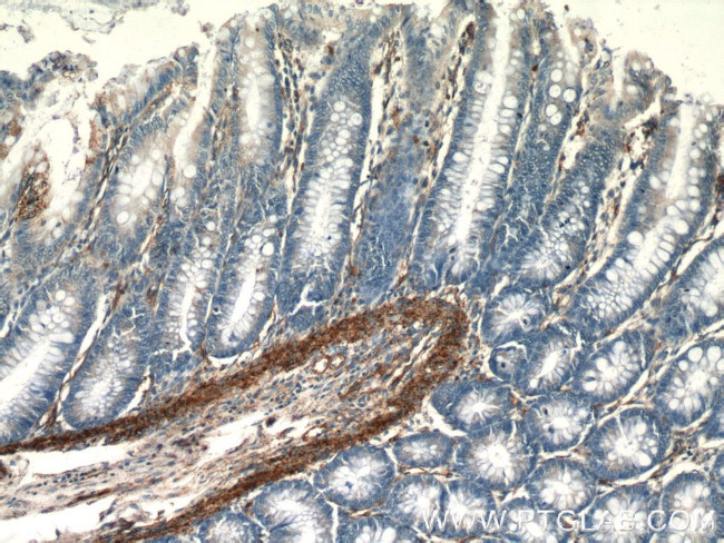 AMPD3 Antibody in Immunohistochemistry (Paraffin) (IHC (P))