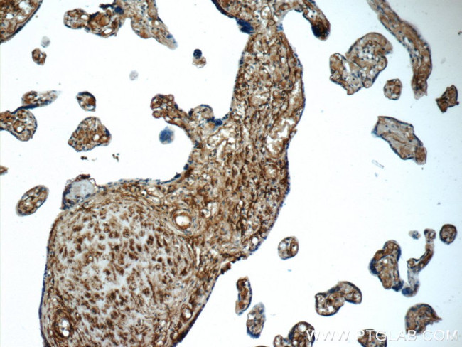 AMPD3 Antibody in Immunohistochemistry (Paraffin) (IHC (P))