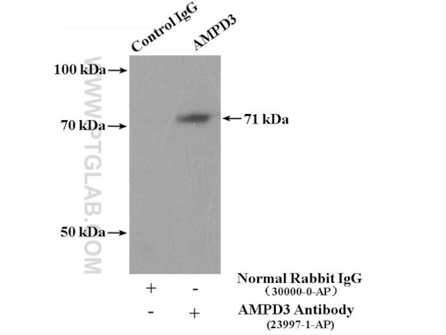 AMPD3 Antibody in Immunoprecipitation (IP)