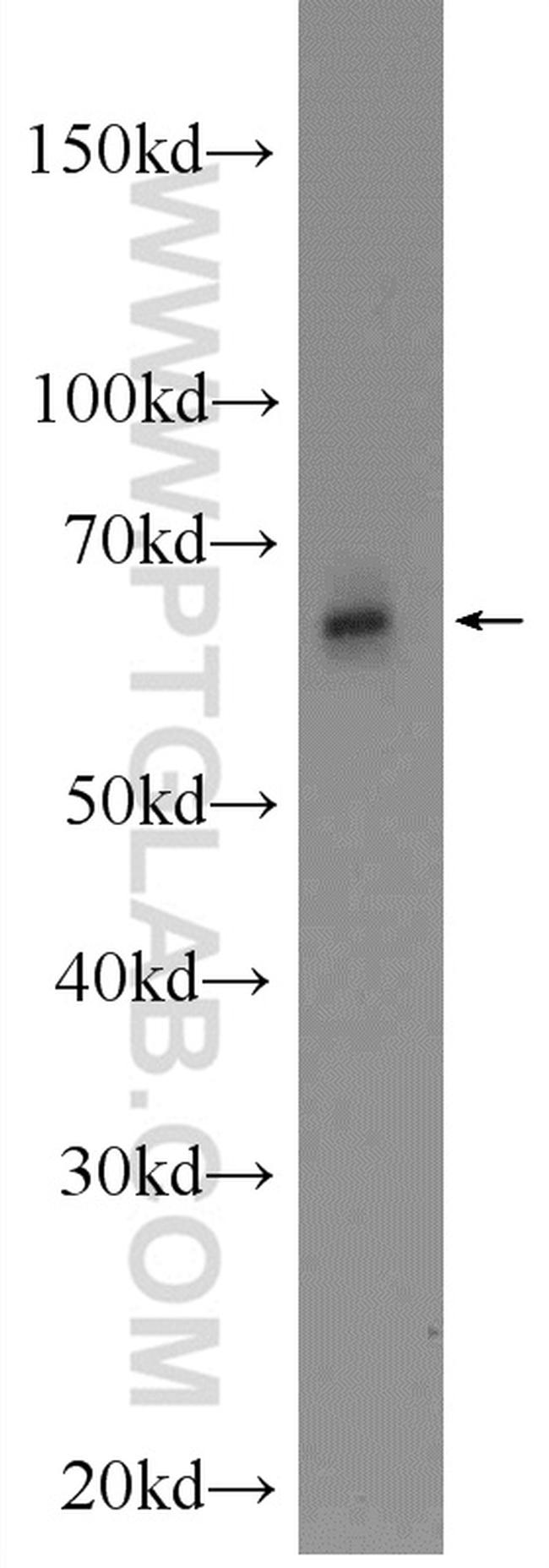 ANKRD13C Antibody in Western Blot (WB)