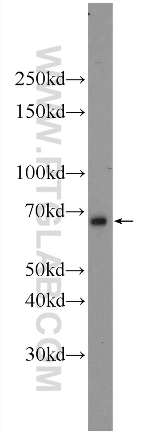ANKRD13C Antibody in Western Blot (WB)