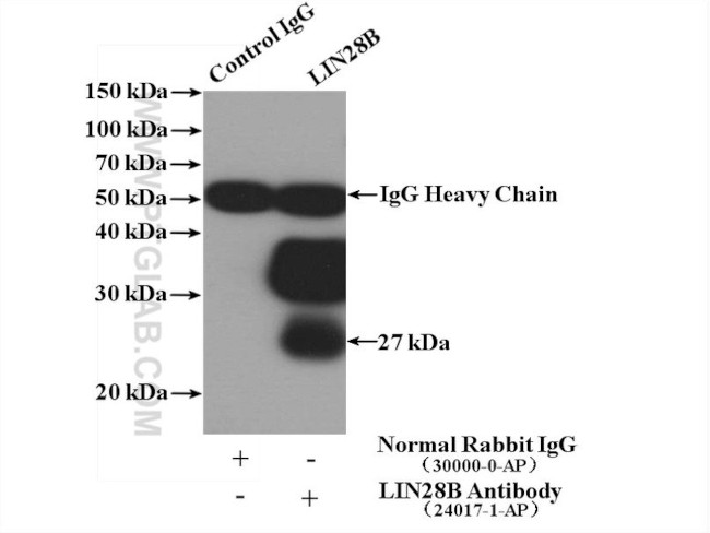 LIN28B Antibody in Immunoprecipitation (IP)