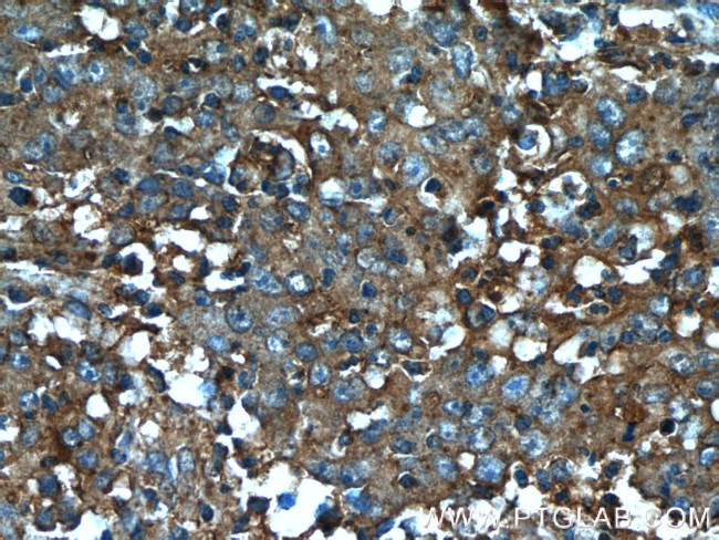 B4GALNT2 Antibody in Immunohistochemistry (Paraffin) (IHC (P))