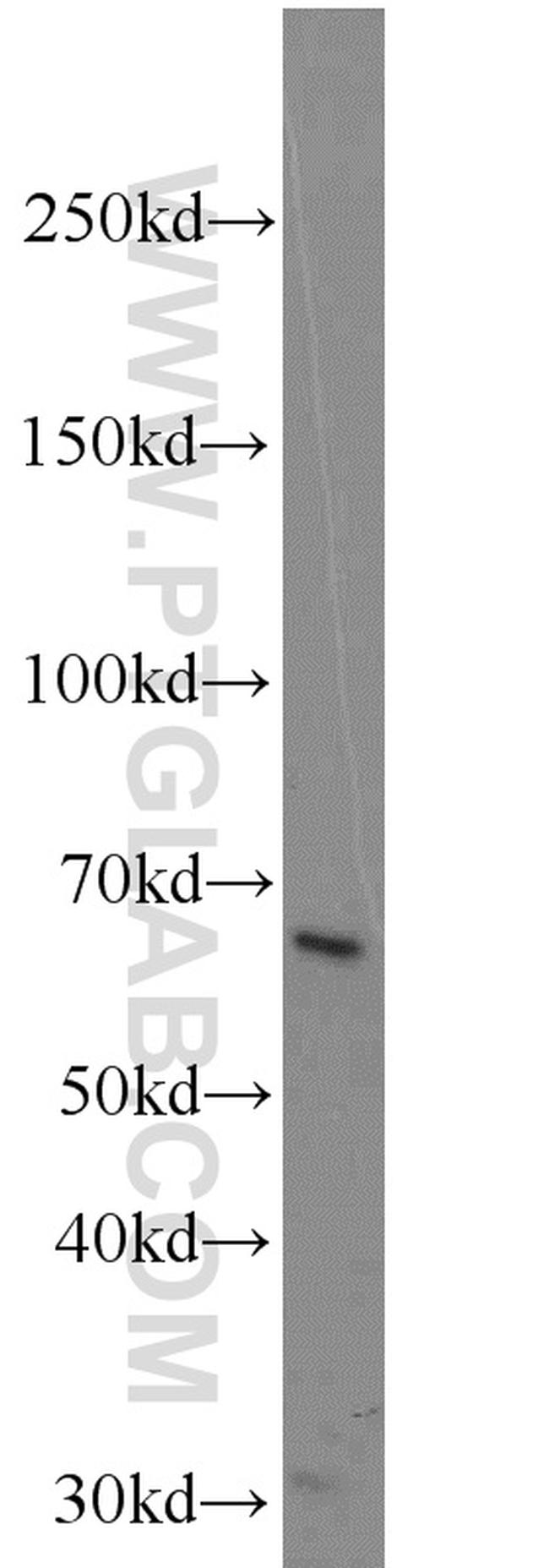 B4GALNT2 Antibody in Western Blot (WB)