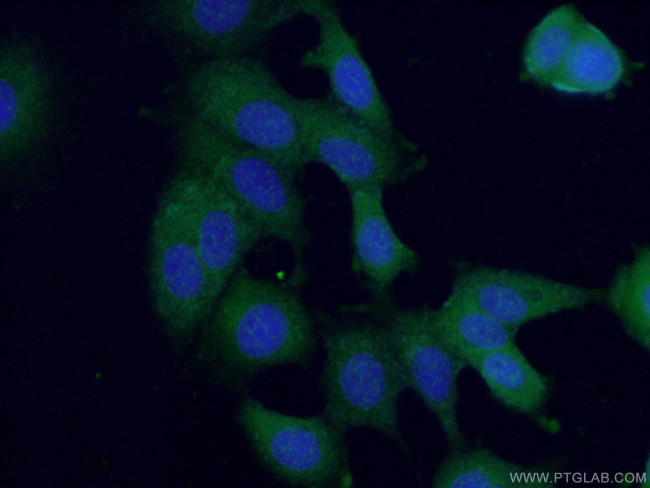 ANKRD27 Antibody in Immunocytochemistry (ICC/IF)