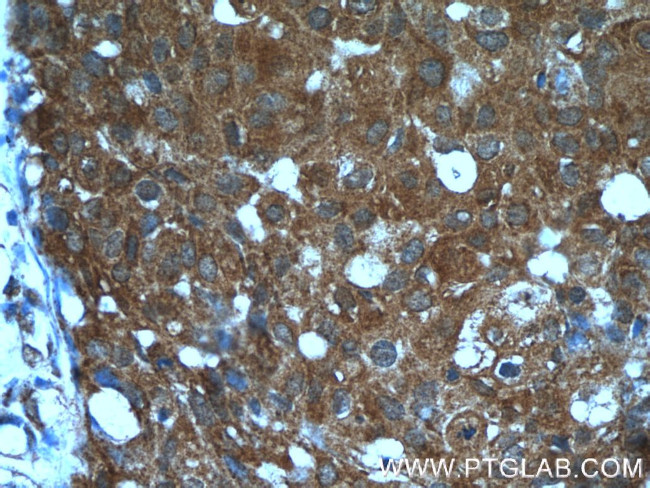 ANKRD27 Antibody in Immunohistochemistry (Paraffin) (IHC (P))