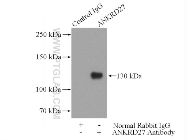 ANKRD27 Antibody in Immunoprecipitation (IP)