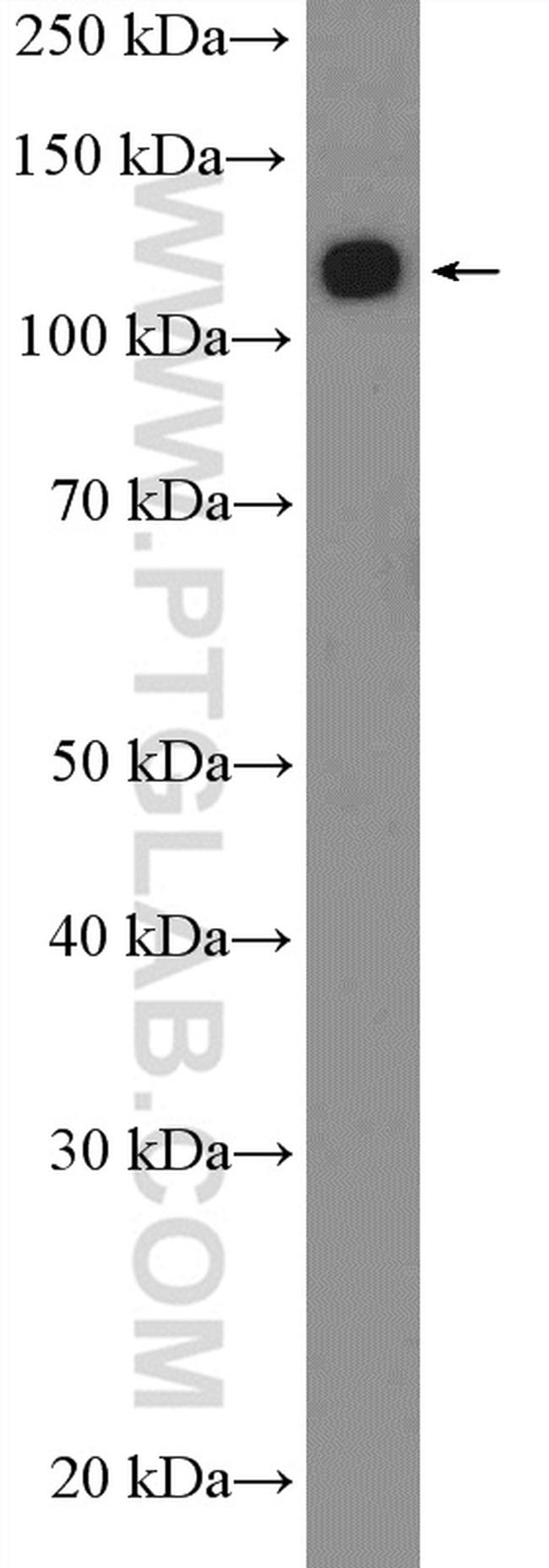 ANKRD27 Antibody in Western Blot (WB)