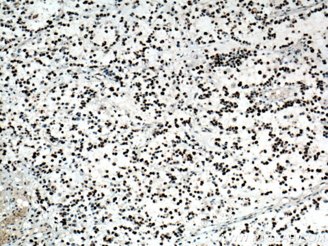 PCNA Antibody in Immunohistochemistry (Paraffin) (IHC (P))