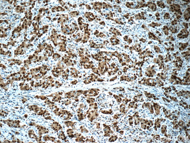 PCNA Antibody in Immunohistochemistry (Paraffin) (IHC (P))