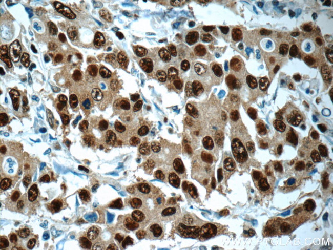 PCNA Antibody in Immunohistochemistry (Paraffin) (IHC (P))