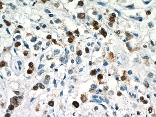 PCNA Antibody in Immunohistochemistry (Paraffin) (IHC (P))