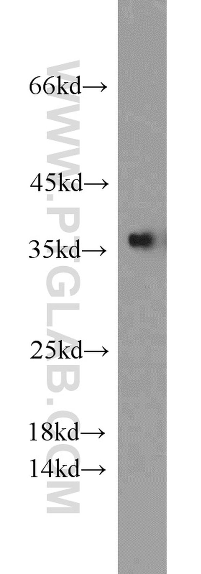 PCNA Antibody in Western Blot (WB)