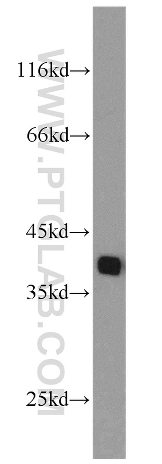 PCNA Antibody in Western Blot (WB)