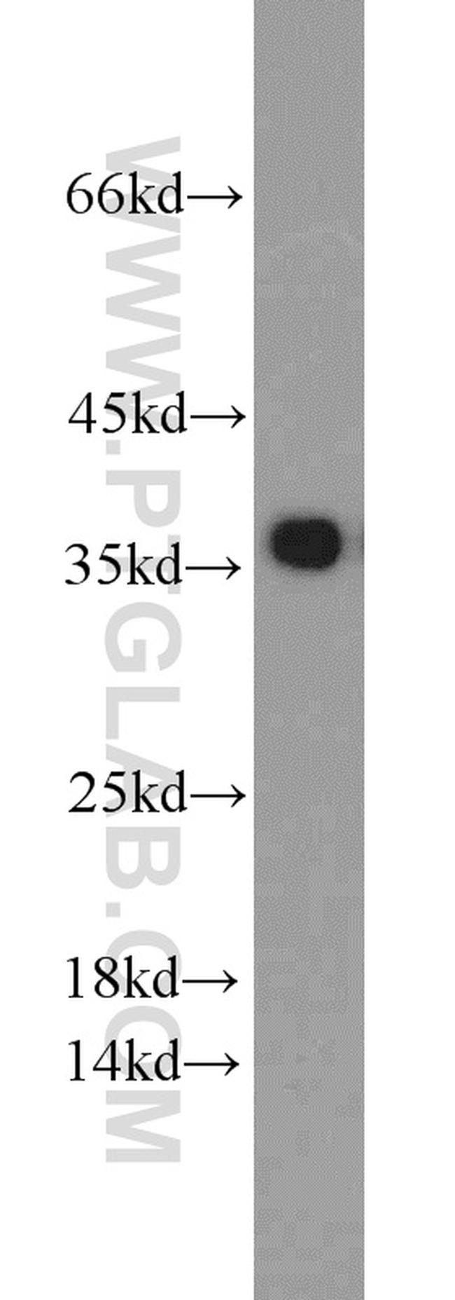 PCNA Antibody in Western Blot (WB)