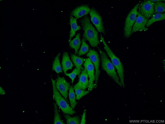 ZDHHC9 Antibody in Immunocytochemistry (ICC/IF)