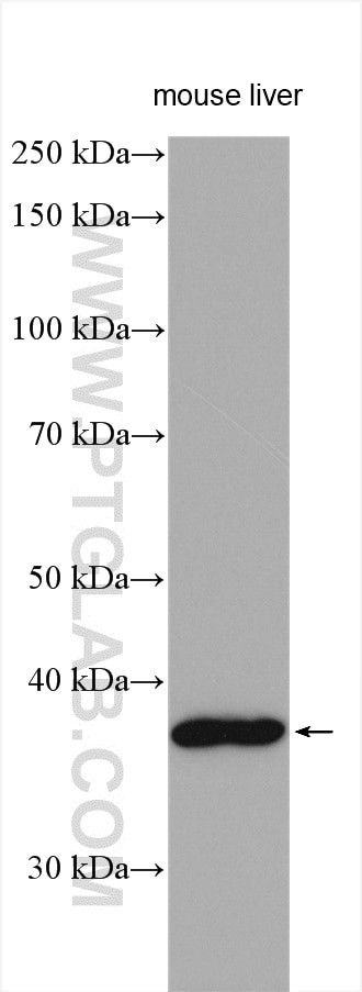 ZDHHC9 Antibody in Western Blot (WB)